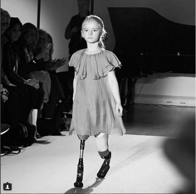 Are doar șapte ani, dar e un munte de voință! Povestea unei fetițe căreia i-au fost amputate picioarele, dar și-a construit o carieră ca model: ”Este OK să fii diferit și să nu te afecteze acest lucru!” 
