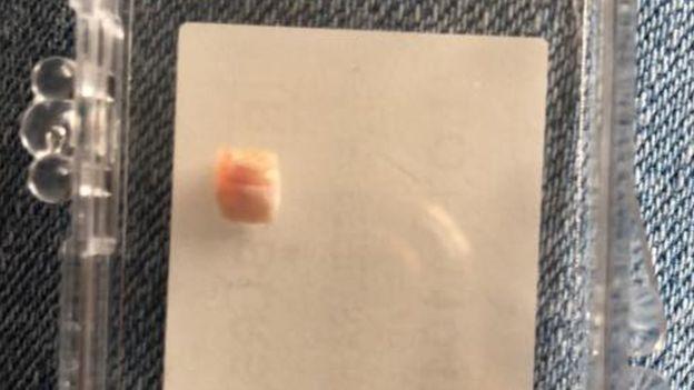 Cazul care i-a uimit pe medici! O fetiță s-a născut cu un dinte, iar la 12 zile a ajuns la dentist! Mărturisirile mamei: ”N-am putut să-mi văd prințesa suferind!”