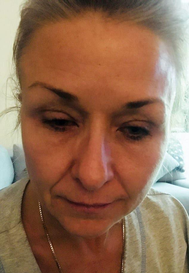 O femeie s-a dat cu mascara timp de mai mulți ani, dar apoi a ajuns de URGENȚĂ la medic! Ce a pățit