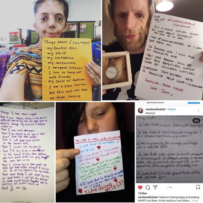 Era prea urât ca să-l iubească! Abandonat la naștere, a ajuns un model pentru mii de tineri din întreaga lume! Cum arată astăzi băiatul pe care mama nu l-a vrut pentru că era „desfigurat”