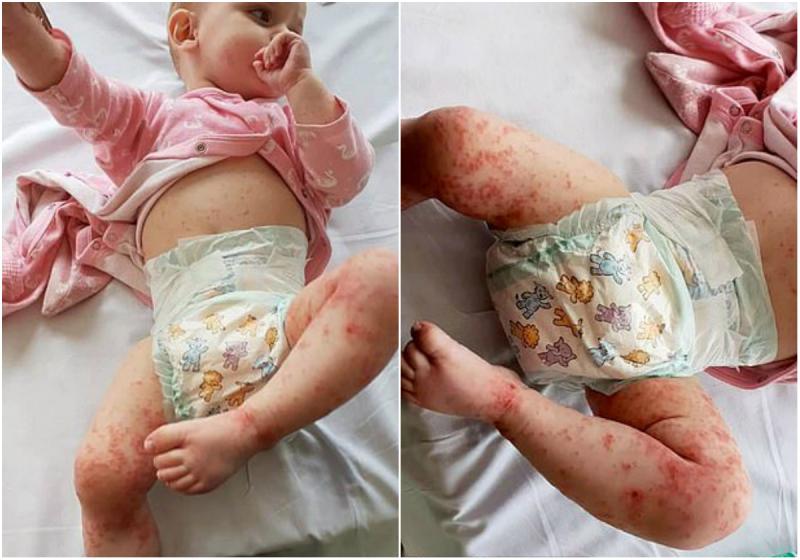 Nu mai pupați bebelușii pe buze! Îngerașul acesta era să moară din cauza unui simplu sărut!