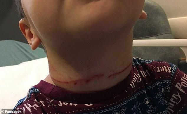 Mesajul unei mame a devenit viral, după ce băiețelul ei a fost la un pas să moară strangulat. Imagini cu puternic impact emoțional!