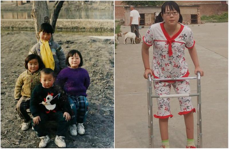 Da, se poate! Dragostea iubitului a trezit-o dintr-o comă de 2 ani! Astăzi, cei doi au o singură dorință