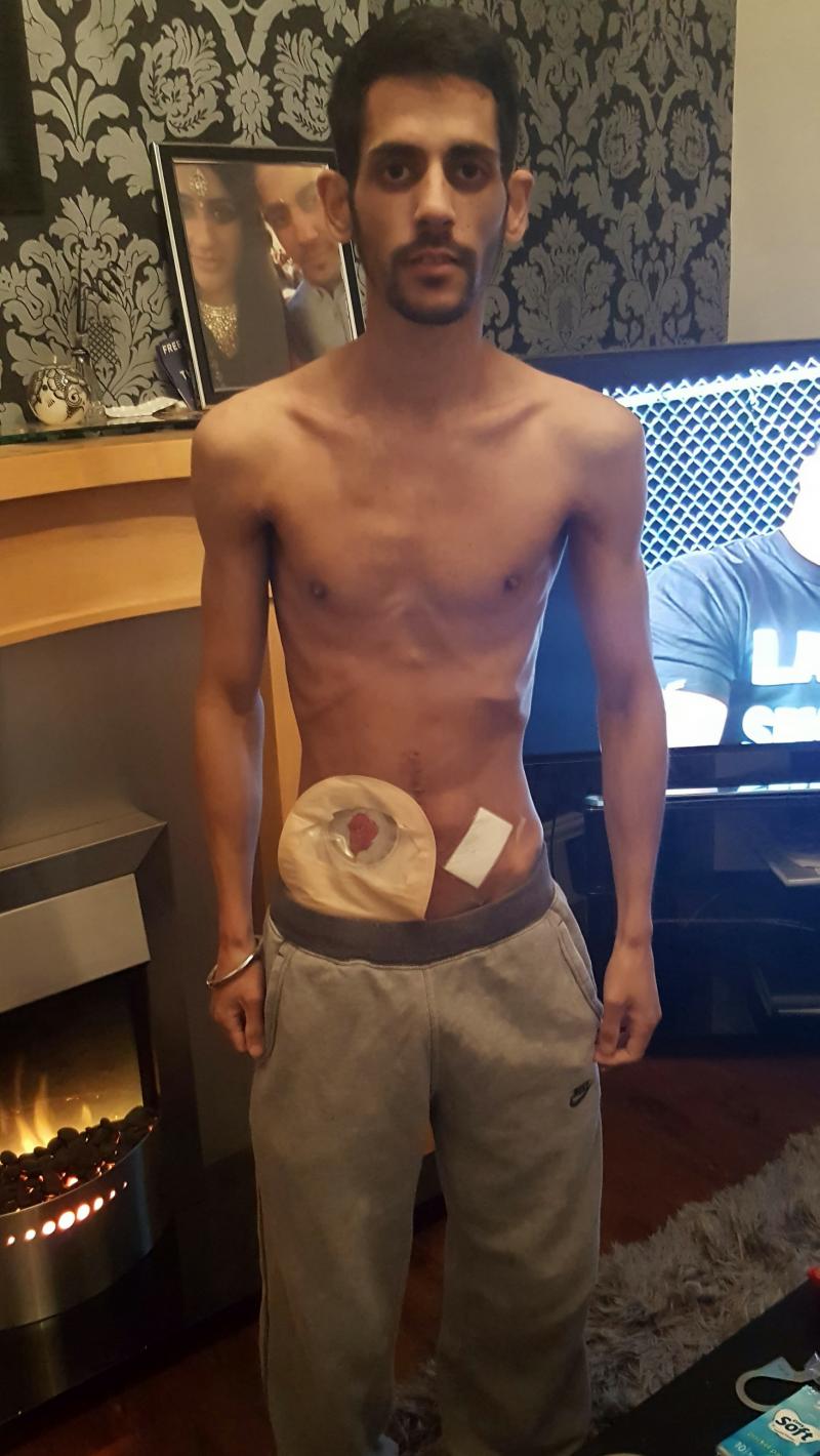 Transformarea spectaculoasă a unui tânăr diagnosticat cu o boală inflamatorie intestinală! A fost slab mort, însă acum e de nerecunoscut!