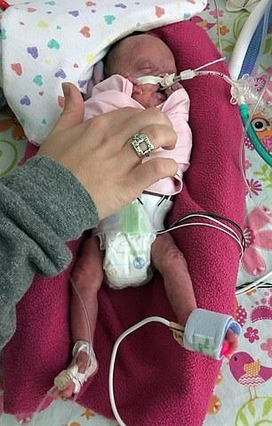 S-au născut la șase luni, cântăreau 600 de grame și au bătut orice record pentru că au trăit. "Ne-au spus că gemenii au 0% șanse"