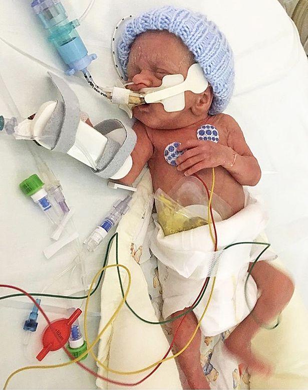 Bebeluș de 500 de grame, cu pielea transparentă! Mama a trăit un șoc când l-a văzut: „Am simțit că...”