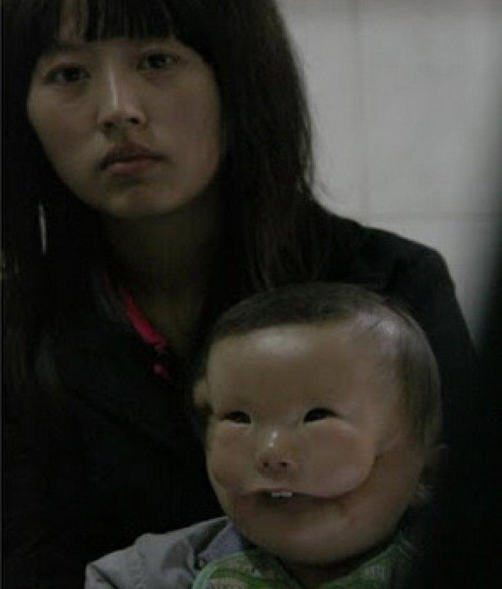 Când a văzut ce a adus pe lume, mama a împietrit de durere! Din cauza unei afecțiuni groaznice, copilul pare că are nu una, ci două fețe!