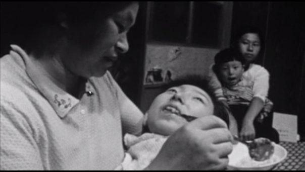 Pisicile aveau convulsii și se aruncau în mare, oamenii erau diagnosticați cu "boala pisicii dansatoare". Dezastrul ecologic din Minamata care a ras viețile a mii de oameni și animale