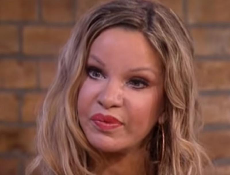 Terifiant! Femeia care şi-a făcut 350 de intervenţii estetice: “Nu îmi vine să cred în ce m-am transformat!“