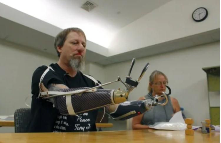 Aproape a murit după ce a fost lins de un câine, iar acum refuză să își dea animalul de companie. Bărbatul a rămas fără mâini și picioare însă și-a păstrat atitudinea pozitivă