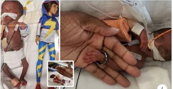 Miracol! Fetița care s-a născut mai mică decât păpușa Barbie pleacă din spital după cinci luni. Cum arată acum