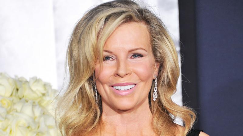 O celebră actriță devine victima operațiilor estetice. Chipul său i-a şocat pe fani