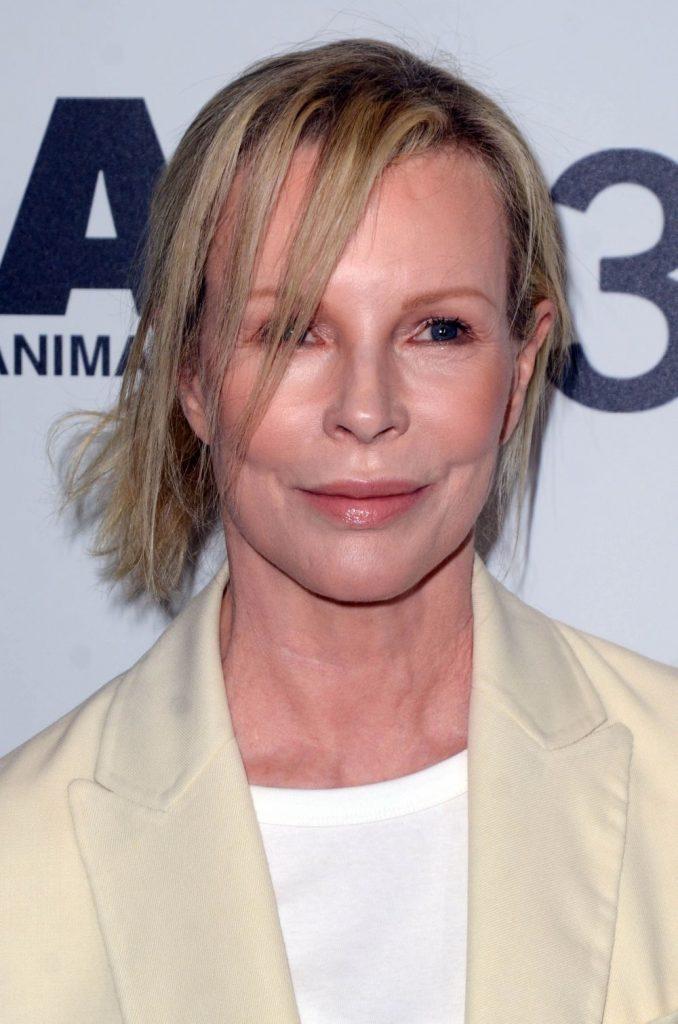 O celebră actriță devine victima operațiilor estetice. Chipul său i-a şocat pe fani