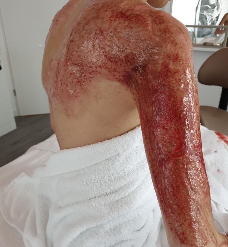 Patru ani de la Colectiv: ”Noi toţi continuăm să ardem!”