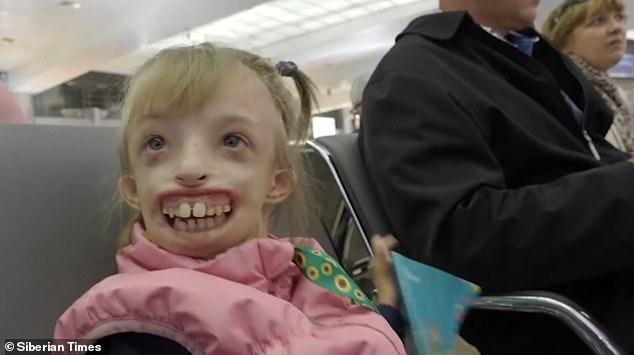 După 11 ore pe masa de operație, Darina poate zâmbi pentru întâia oară: „Înainte, ceilalți copii plângeau când îi vedeau chipul”