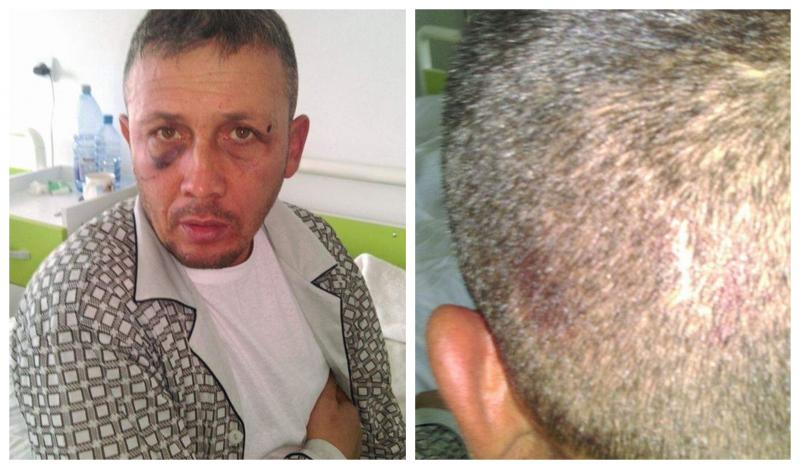 Răsturnare de situație în cazul Caracal! Alexandru Cumpănașu a publicat imagini tulburătoare! Ce i-a spus familia Luizei Melencu. „Priviți!” - Foto