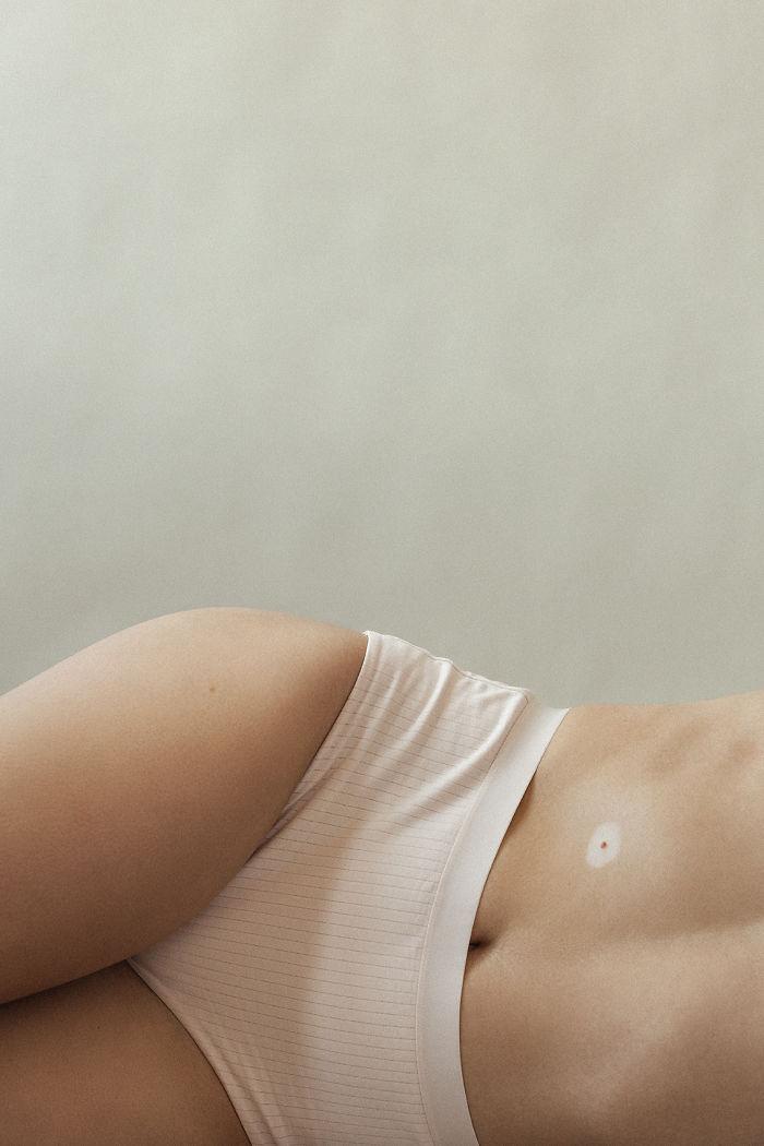 Imagini fabuloase - Suferă de aceeași boală ca Michael Jackson, dar a ridicat "defectul" la rang de artă!