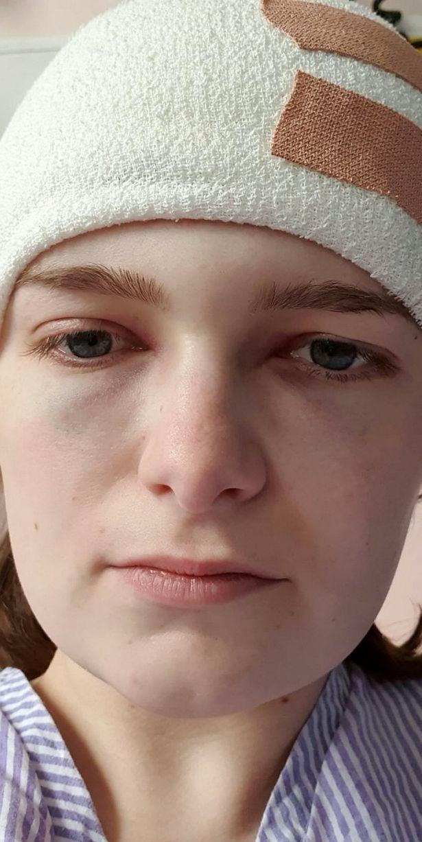 Ziua Mondială a Victimelor Traficului Rutier: O tânără a vorbit despre cum și-a pierdut jumătate din craniu din cauza unui accident rutier - FOTO