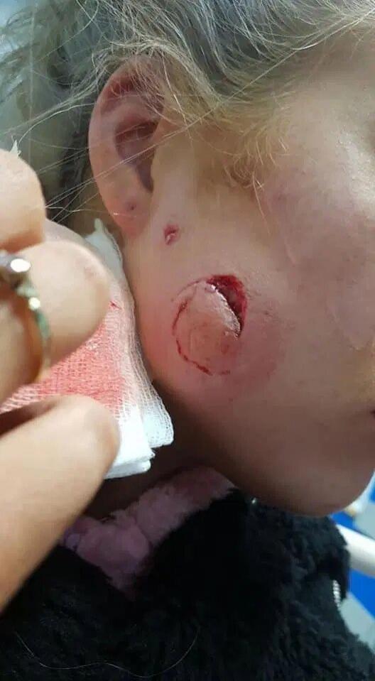 Un tânăr a ajuns la închisoare după ce și-a mușcat brutal fosta iubită de obraz! „A obținut ceea ce a meritat. Sunt atât de bucuroasă că s-a terminat” - FOTO