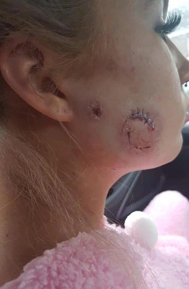 Un tânăr a ajuns la închisoare după ce și-a mușcat brutal fosta iubită de obraz! „A obținut ceea ce a meritat. Sunt atât de bucuroasă că s-a terminat” - FOTO