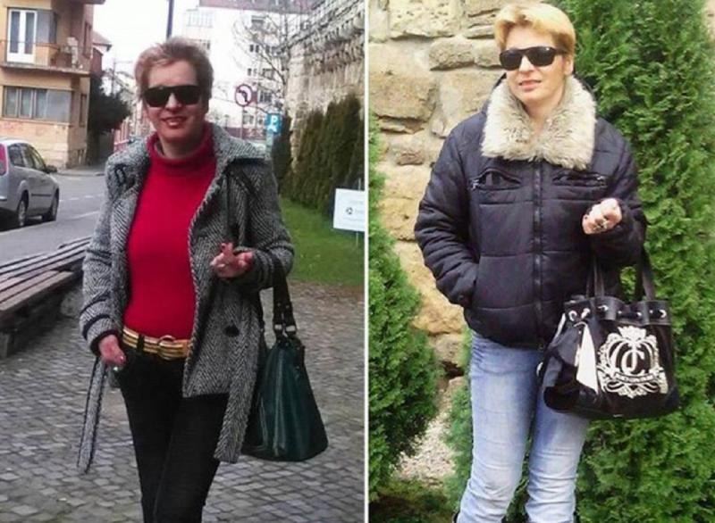 Îți amintești de Ligia, femeia care a ajuns la bisturiu, în direct? Cum arată azi „Sharon Stone” de Cluj