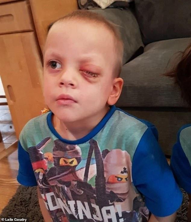 Un băiețel de patru ani a rămas fără un ochi. Totul a început cu o fotografie de familie: „Mi-am dat seama imediat că ceva era în neregulă”