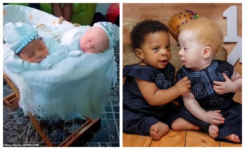 Unul alb, altul de culoare, deși au fost născuți la câteva minute diferență! Cum a reacționat mama lor când i-a văzut. „A trebuit să răspund la multe întrebări” – Foto