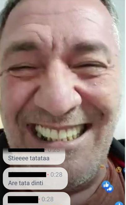 FOTO | Bomba anului: Nelson Mondialu și-a pus dinți! S-a dus bogăția și la gură! Cum arată acum