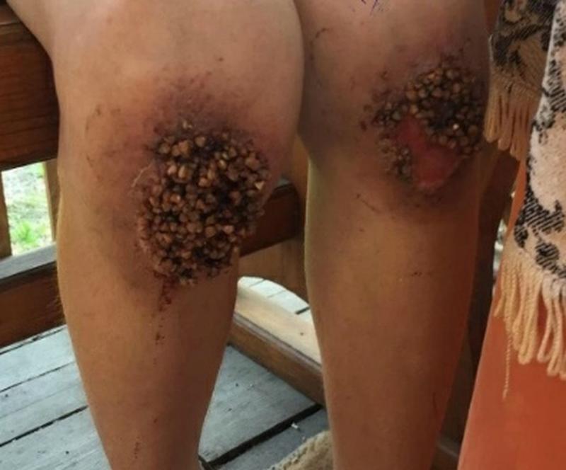 Șeful unei companii de IT, acuzat că și-a torturat fiul vitreg. Copilul a intrat direct în sala de operație după ce a fost ținut în genunchi pe boabe de hrișcă