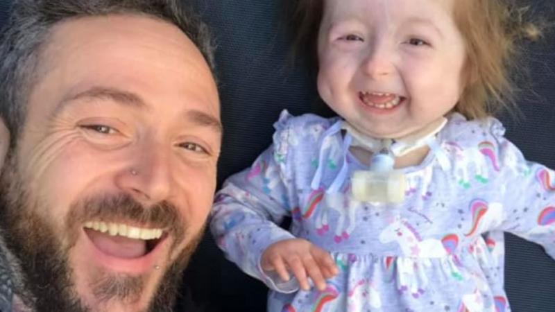 O fetiță de doi ani suferă de „boala lui Benjamin Button”! Este singurul om diagnosticat cu această maladie! Cum arată copila care uimește medicii – FOTO
