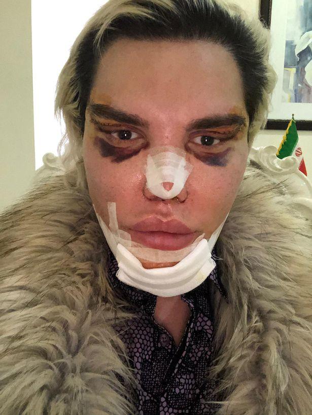 Fotografia care face înconjurul internetului. Un bărbat a fost operat de urgență și a crezut că totul va fi bine. La puțin timp și-a dat seama de efect!