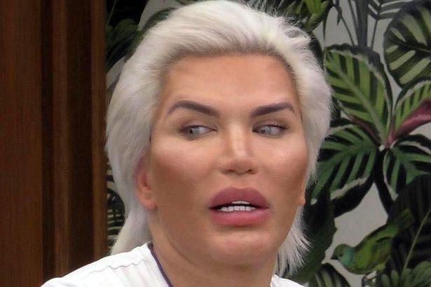 Fotografia care face înconjurul internetului. Un bărbat a fost operat de urgență și a crezut că totul va fi bine. La puțin timp și-a dat seama de efect!