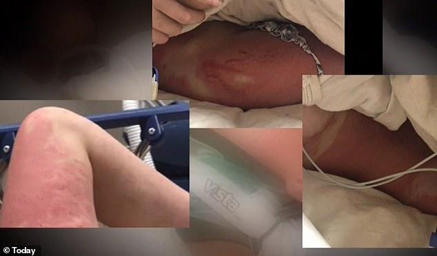 Au filmat-o când a fost împinsă de pe un pod și au pus imaginile online. Adolescenta de 16 ani a avut aproape toate oasele din corp rupte, dar a a luptat să trăiască