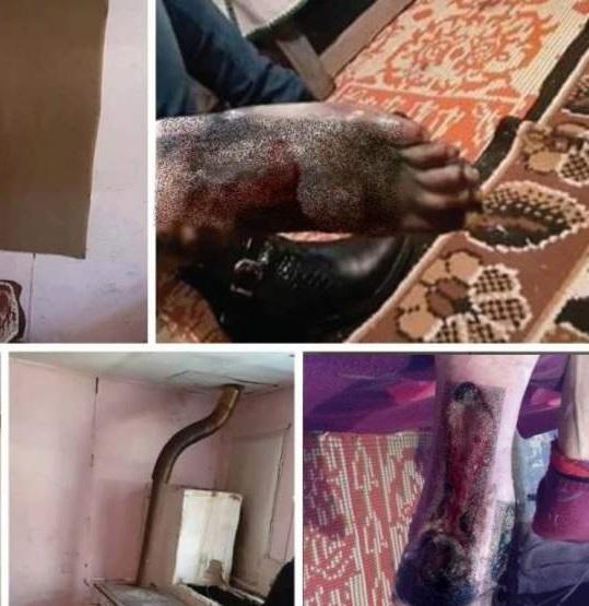 Bătrâna cu piciorul cangrenat, tratată acasă de asistente, a murit! Femeile s-au lăudat cu munca lor pe Facebook