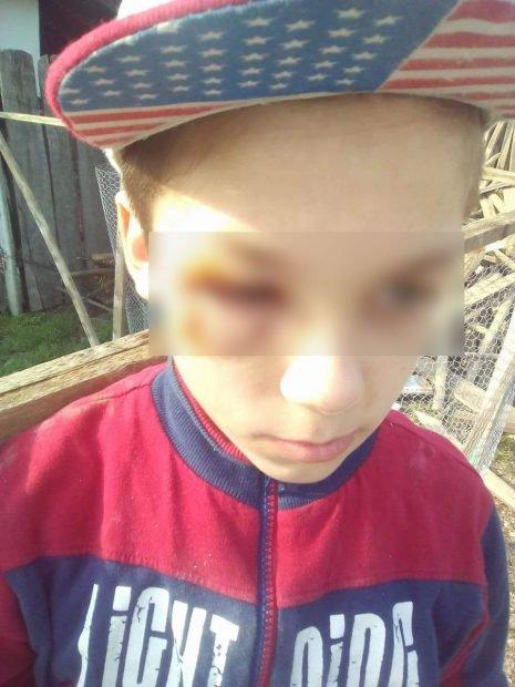 Adevărul despre cazul scandalos de la Vaslui! De ce și-a bătut o mamă de 39 de ani copilul: ”Voia să-i facă pe plac lui!”