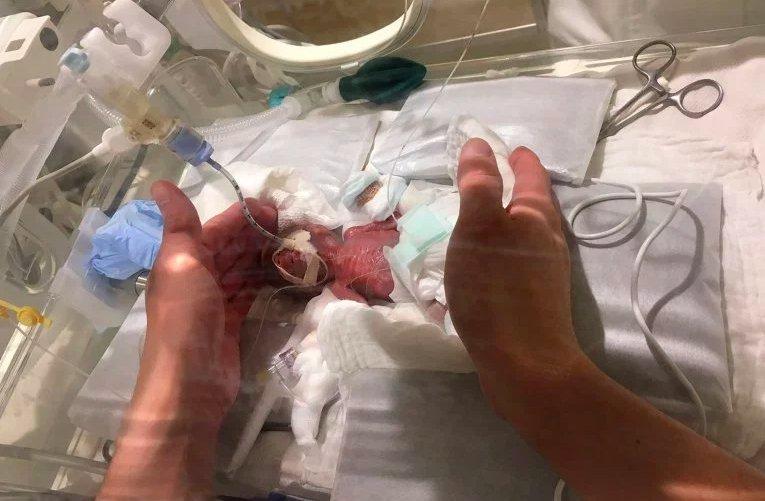 Premiera medicală care a emoționat o lume întreagă! Cel mai mic bebeluș din lume, care a cântărit la naștere 268 de grame, a supraviețuit în mod miraculos