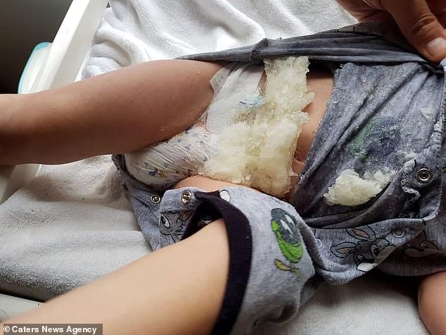 Mesajul unui tată a devenit viral, după ce băiețelul lui a fost la un pas să moară din cauza scutecului. Bărbatul își crește singur fiul