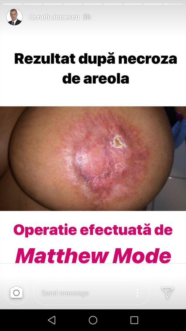 Doamne, Dumnezeule! Vezi cum a mutilat o femeie falsul medic Matteo Politi! Atenție, imagini needitate!!!