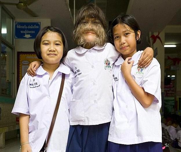 A fost numită „cea mai păroasă fată din lume”. Tânăra și-a arătat chipul pentru prima oară, imediat după ce s-a căsătorit. Oare cum a reacționat mirele?