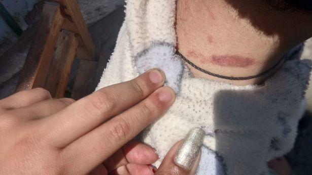 Ținut în lanțuri și ars cu țigara! Un copil de 6 ani a suferit abuzuri înfiorătoare. Atenție, imagini cu un puternic impac emoțional! - Foto