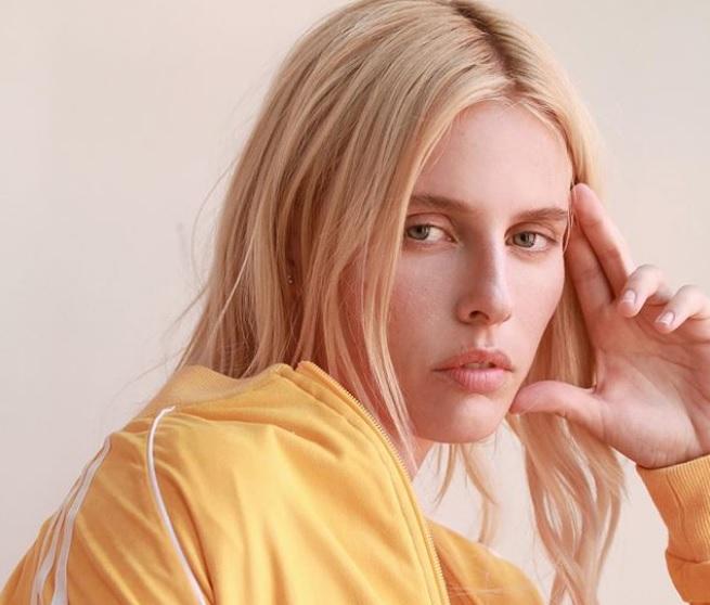 O t&acirc;nără cu chip de &icirc;nger a rămas fără picioare din cauza unui tampon! &bdquo;Acum am un singur scop &icirc;n viață&rdquo; &ndash; Foto