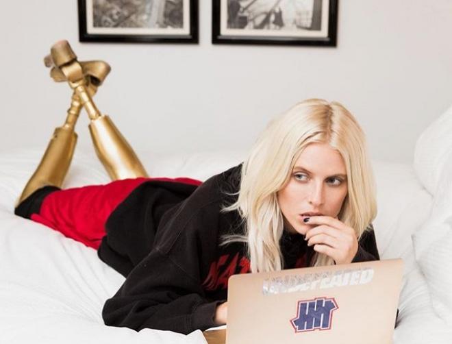 O t&acirc;nără cu chip de &icirc;nger a rămas fără picioare din cauza unui tampon! &bdquo;Acum am un singur scop &icirc;n viață&rdquo; &ndash; Foto