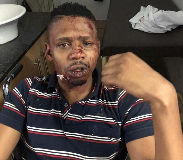Prezentator tv, bătut cu violență! Tânărul a ajuns de urgență la spital cu răni grave (FOTO)