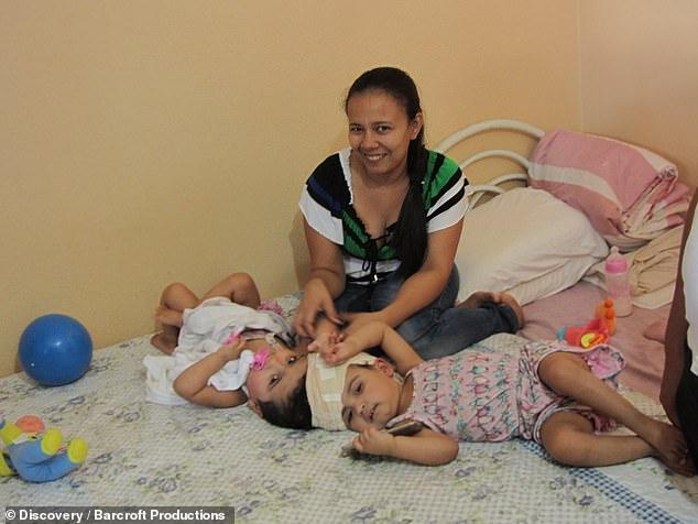 S-au născut unite, fără să se poată vedea vreodată una pe cealaltă. Părinții au riscat totul pentru a le da o șansă la viață