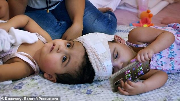 S-au născut unite, fără să se poată vedea vreodată una pe cealaltă. Părinții au riscat totul pentru a le da o șansă la viață