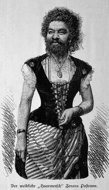 „Cea mai urâtă femeie din istorie” a avut 20 de cereri în căsătorie, dar a iubit un singur bărbat. Povestea tragică a Iuliei, cea care nu a fost considerată om