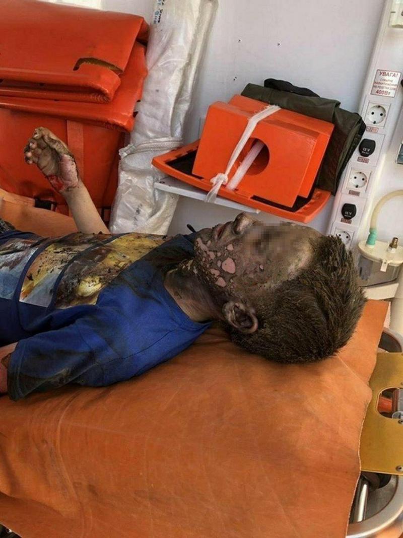 Un puști de 14 ani s-a curentat la 10.000 de volți și a supraviețuit! Medicii: ”E cel mai norocos!”