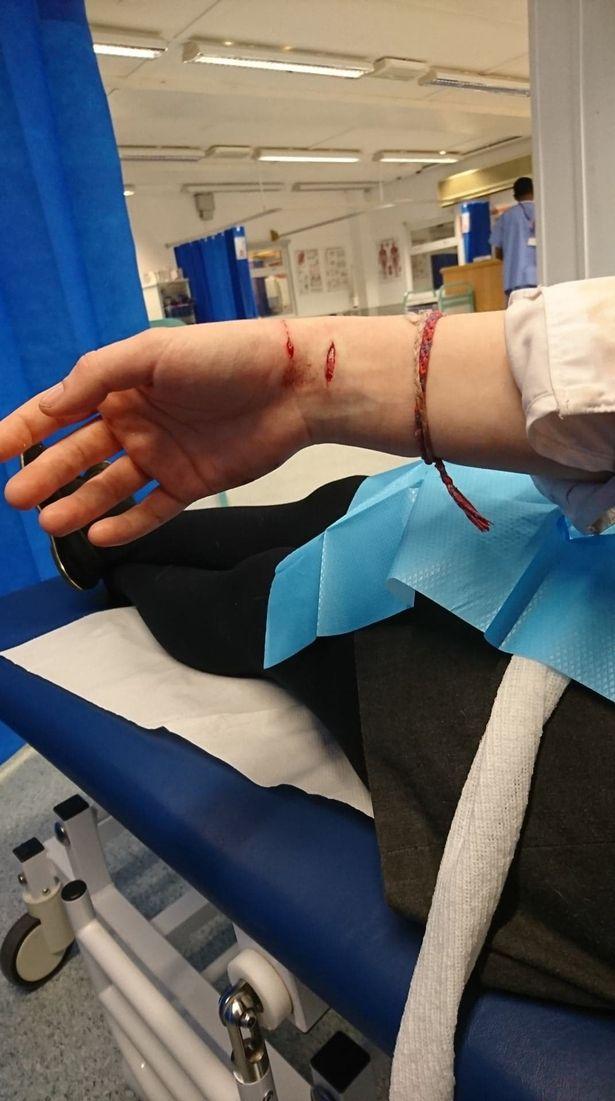 I-a smuls brațul! Câinele a atacat o tânără și a sfârtecat un alt câine! „Piciorul și șoldul erau smulse și era sânge ...” (FOTO)