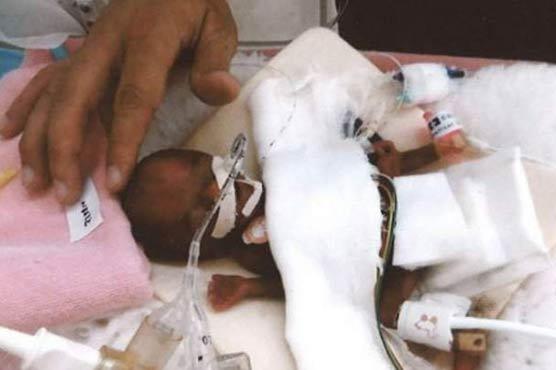 Un bebeluș s-a născut la doar trei luni, având 258 de grame! Cum arată