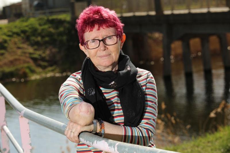 I-a smuls brațul într-o secundă! O femeie a fost atacată de propriul câine, de 90 de kilograme